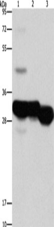 Rabbit Polyclonal Antibody to KHK
