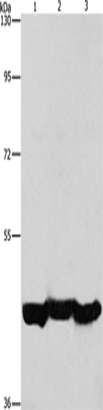 Rabbit Polyclonal Antibody to PGK1
