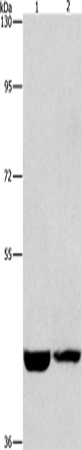 Rabbit Polyclonal Antibody to CSNK1E