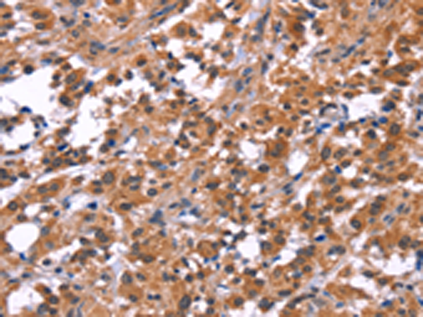 Rabbit Polyclonal Antibody to PIP5K1B