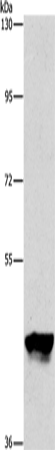 Rabbit Polyclonal Antibody to PIP4K2A