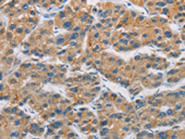 Rabbit Polyclonal Antibody to CERK
