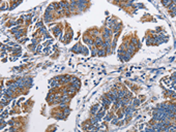 Rabbit Polyclonal Antibody to NPPA