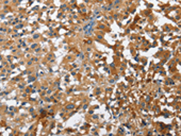 Rabbit Polyclonal Antibody to STK17B
