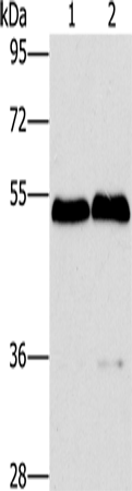 Rabbit Polyclonal Antibody to SPHK2