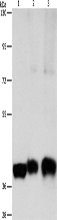 Rabbit Polyclonal Antibody to ASAH1