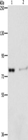 Rabbit Polyclonal Antibody to ASAH2