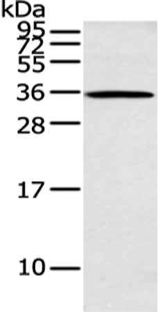 Rabbit Polyclonal Antibody to ASB8