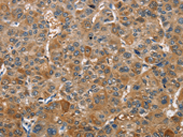 Rabbit Polyclonal Antibody to TRIP4