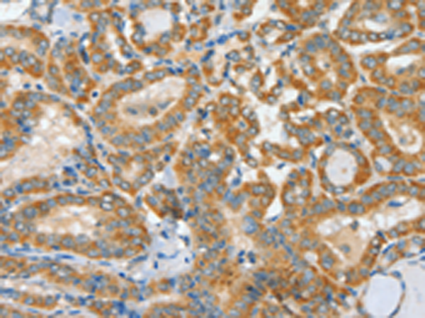 Rabbit Polyclonal Antibody to ASCC1