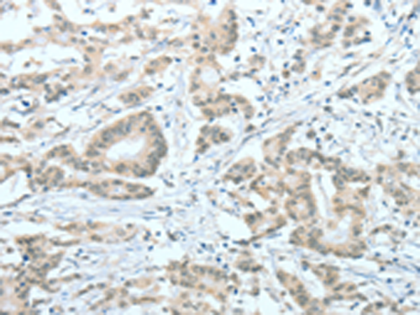 Rabbit Polyclonal Antibody to ASH2L