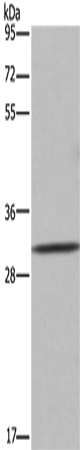 Rabbit Polyclonal Antibody to ASGR1