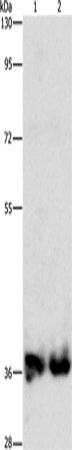 Rabbit Polyclonal Antibody to ASPA