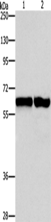 Rabbit Polyclonal Antibody to ASNS