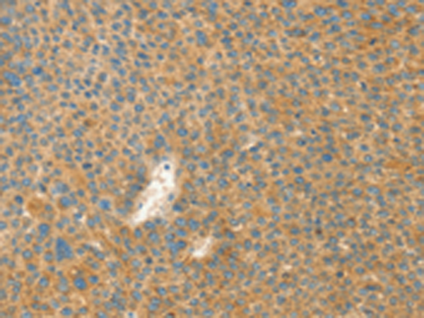 Rabbit Polyclonal Antibody to AANAT