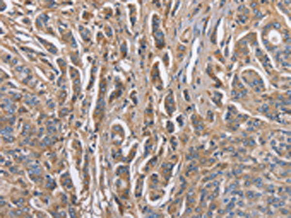 Rabbit Polyclonal Antibody to ABI3BP