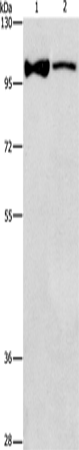 Rabbit Polyclonal Antibody to ADCY3