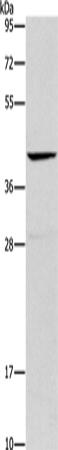 Rabbit Polyclonal Antibody to ORM2