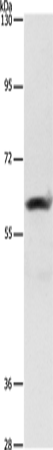 Rabbit Polyclonal Antibody to AIFM3
