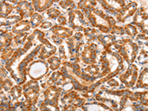 Rabbit Polyclonal Antibody to AIM2