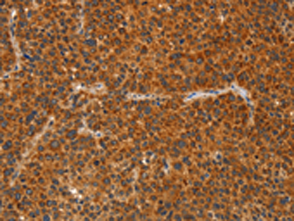 Rabbit Polyclonal Antibody to IKZF3