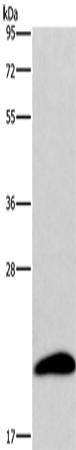 Rabbit Polyclonal Antibody to AURKAIP1