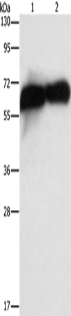 Rabbit Polyclonal Antibody to ALPP