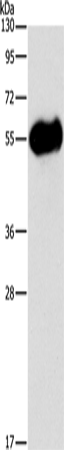 Rabbit Polyclonal Antibody to AMY2A