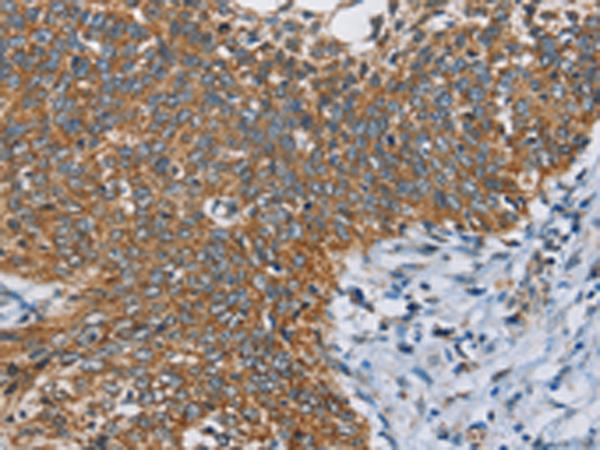 Rabbit Polyclonal Antibody to ANKHD1