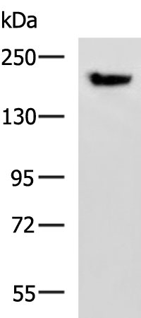 Rabbit Polyclonal Antibody to PDS5B
