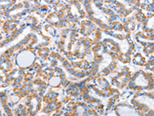 Rabbit Polyclonal Antibody to ARL11