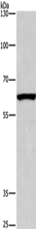 Rabbit Polyclonal Antibody to ARMCX2