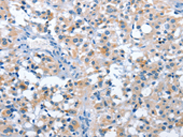 Rabbit Polyclonal Antibody to ASB2