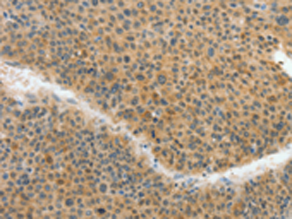 Rabbit Polyclonal Antibody to ACLY