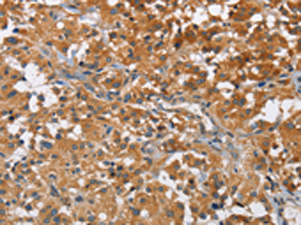 Rabbit Polyclonal Antibody to ATP1B2