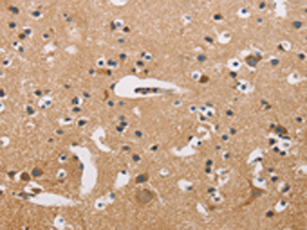 Rabbit Polyclonal Antibody to ATP2C1