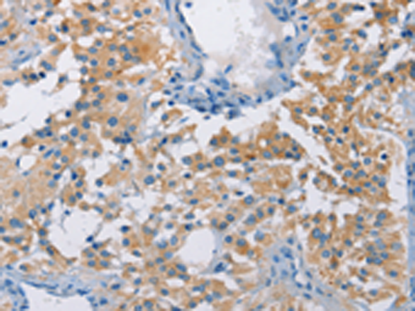 Rabbit Polyclonal Antibody to ATP6AP2