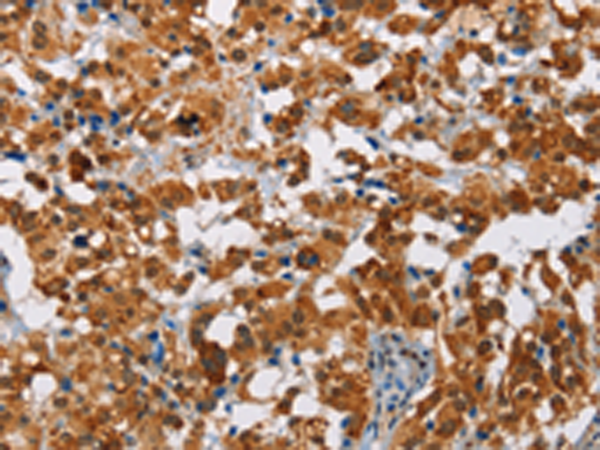 Rabbit Polyclonal Antibody to ATXN1
