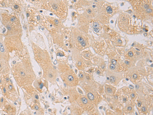 Rabbit Polyclonal Antibody to PDCD1LG2