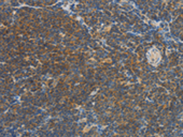 Rabbit Polyclonal Antibody to VTCN1