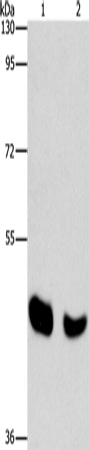 Rabbit Polyclonal Antibody to BAAT