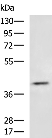 Rabbit Polyclonal Antibody to BCAT1