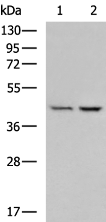 Rabbit Polyclonal Antibody to BCAT2