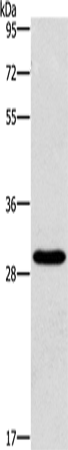 Rabbit Polyclonal Antibody to BCL10