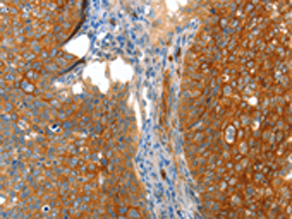 Rabbit Polyclonal Antibody to VWA5A