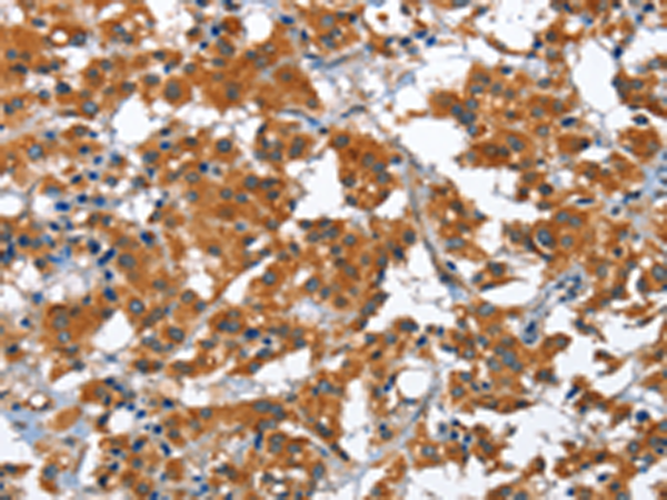 Rabbit Polyclonal Antibody to COPB1