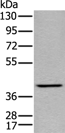 Rabbit Polyclonal Antibody to SH3GLB1