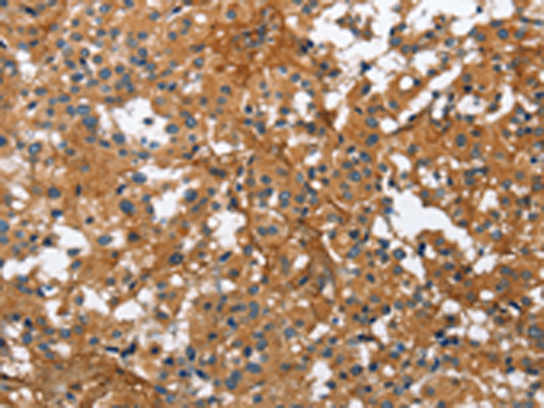 Rabbit Polyclonal Antibody to BGN