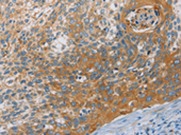 Rabbit Polyclonal Antibody to KCNMA1