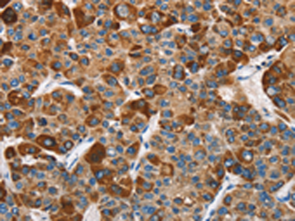 Rabbit Polyclonal Antibody to SLAMF8